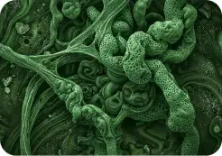 Varicose-veins